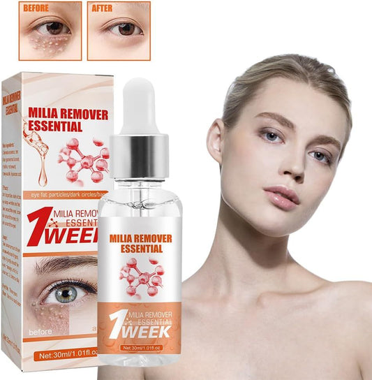 Fast-Acting Milia Removal Serum