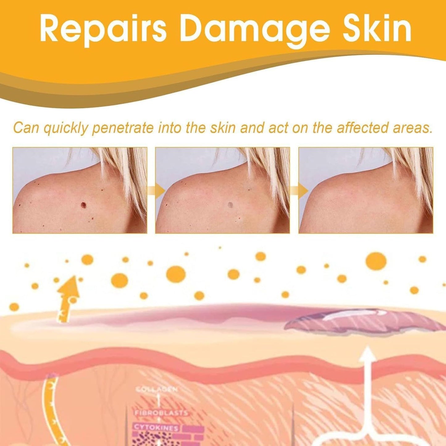 Instant Wart & Tag Removal Spray