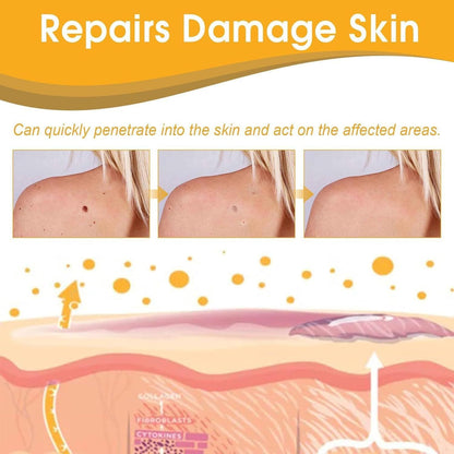 Instant Wart & Tag Removal Spray