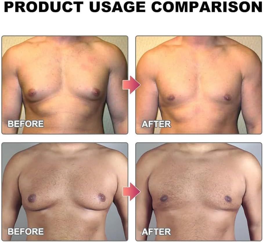 MenTherm Bee Venom Gynecomastia Heating Oil