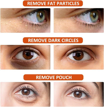 Fast-Acting Milia Removal Serum