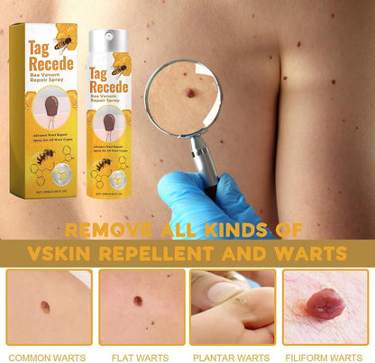 Instant Wart & Tag Removal Spray